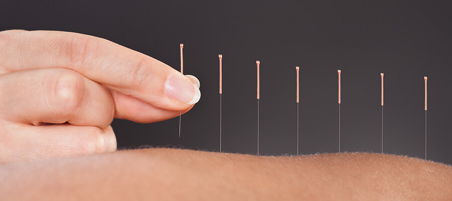 Acupuncture in Midtown Manhattan